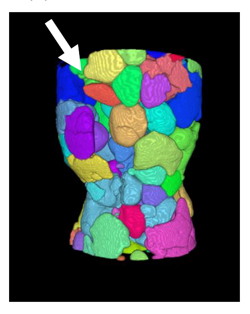 3D image of semisolid